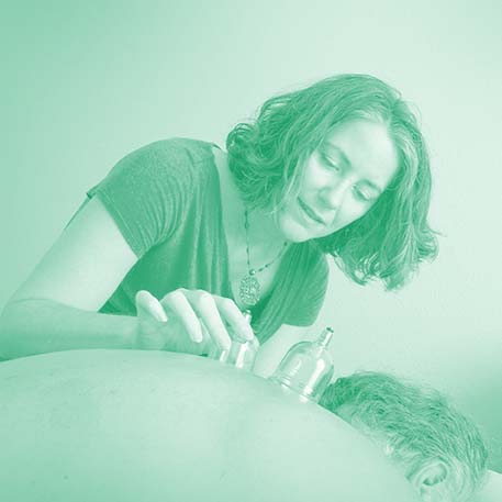 Kathleen giving a cupping treatment (nearby in Scottsdale)