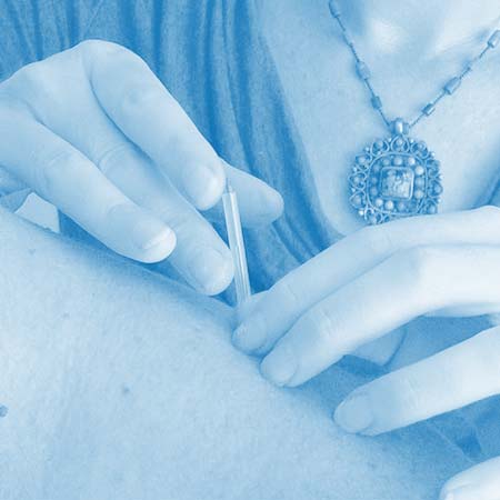 acupuncturist woman inserting needles into patient's shoulder