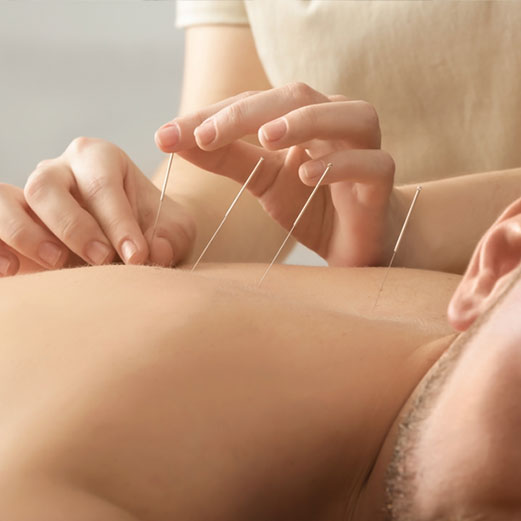 Acupuncture Tune-up