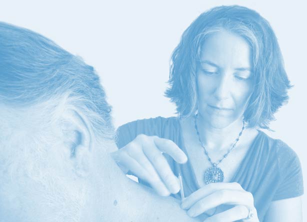 Kathleen inserting acupuncture needle into a client's shoulder
